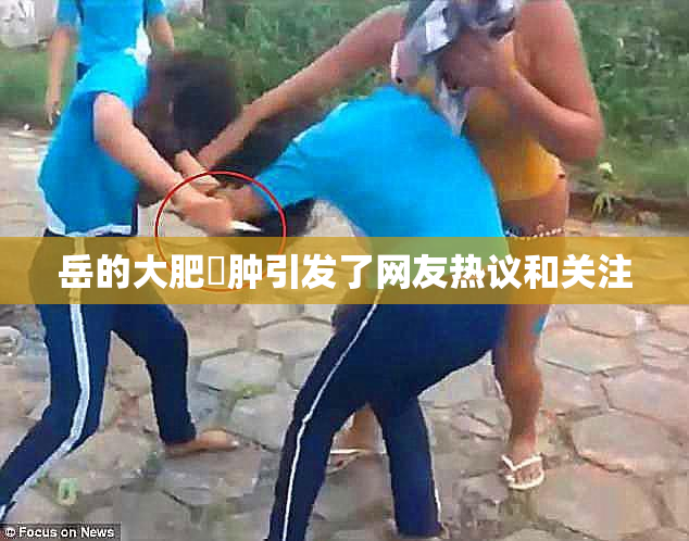 岳的大肥坹肿引发了网友热议和关注