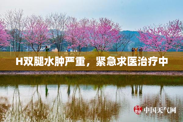 H双腿水肿严重，紧急求医治疗中