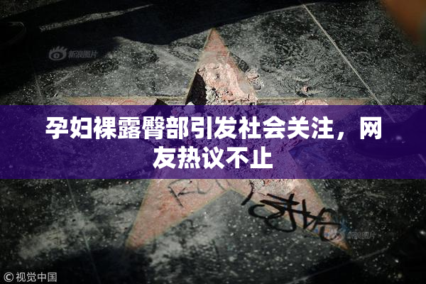 孕妇裸露臀部引发社会关注，网友热议不止
