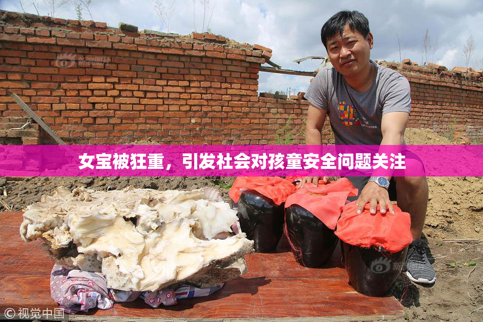 女宝被狂重，引发社会对孩童安全问题关注