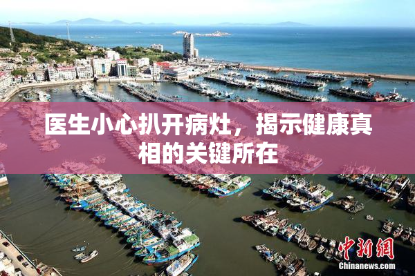 医生小心扒开病灶，揭示健康真相的关键所在