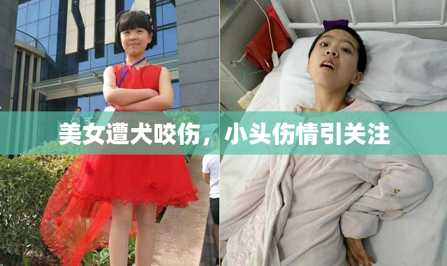 美女遭犬咬伤，小头伤情引关注