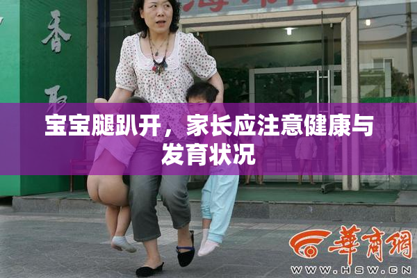 宝宝腿趴开，家长应注意健康与发育状况