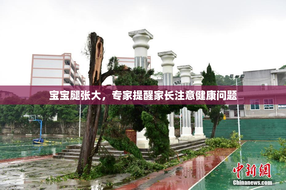 宝宝腿张大，专家提醒家长注意健康问题