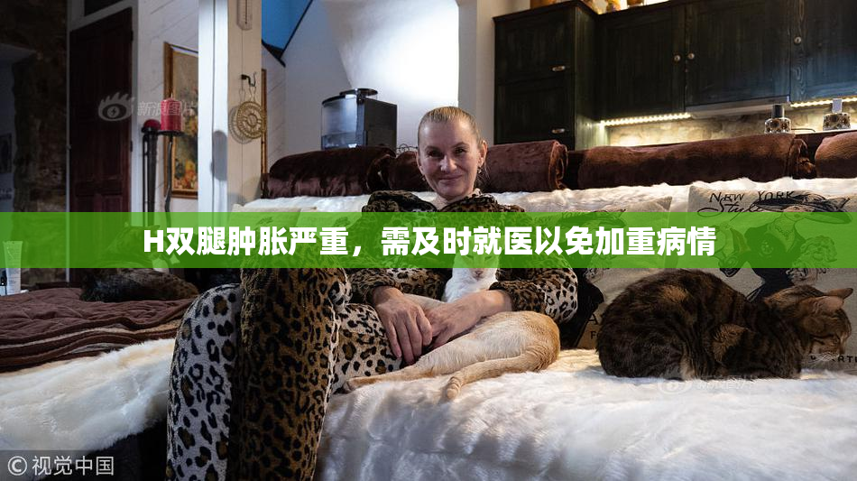 H双腿肿胀严重，需及时就医以免加重病情