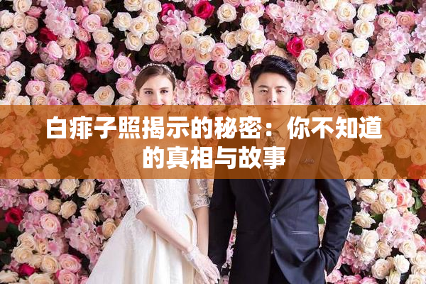 白痱子照揭示的秘密：你不知道的真相与故事