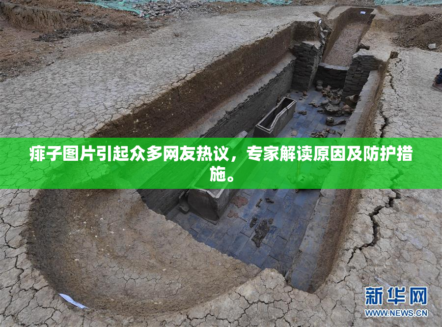 痱子图片引起众多网友热议，专家解读原因及防护措施。