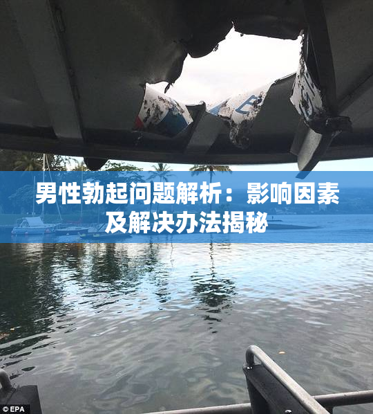 男性勃起问题解析：影响因素及解决办法揭秘